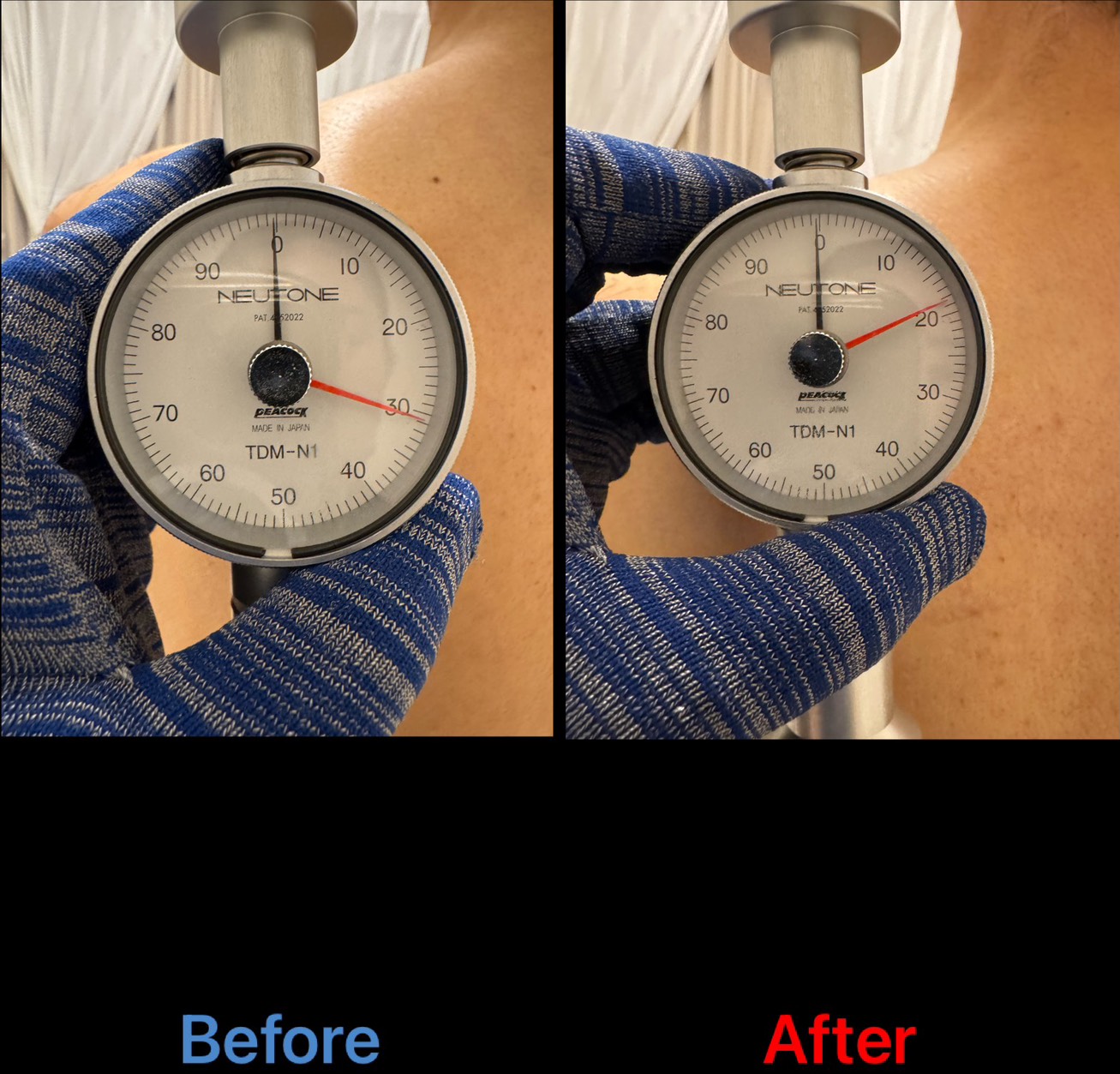 肩まわりの硬さ変化（Before/After）